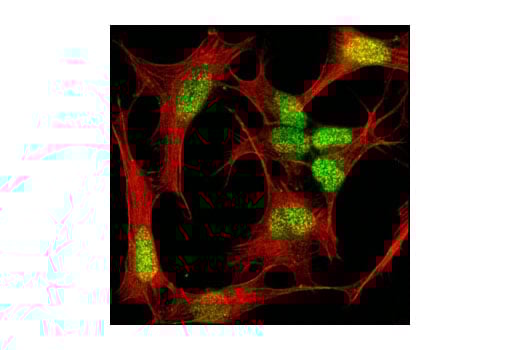 Immunofluorescence Image 1: MeCP2 (D4F3) XP<sup>®</sup> Rabbit mAb