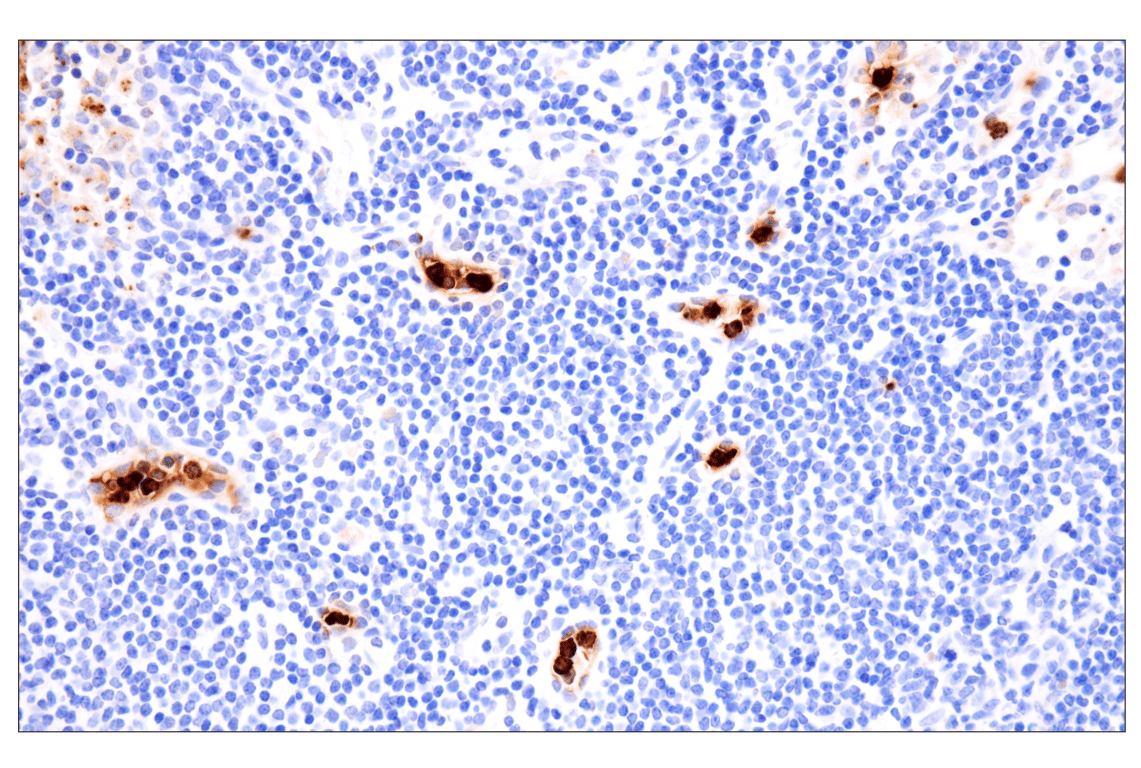 Immunohistochemistry Image 8: Neutrophil Elastase (F4H3X) Rabbit mAb (BSA and Azide Free)