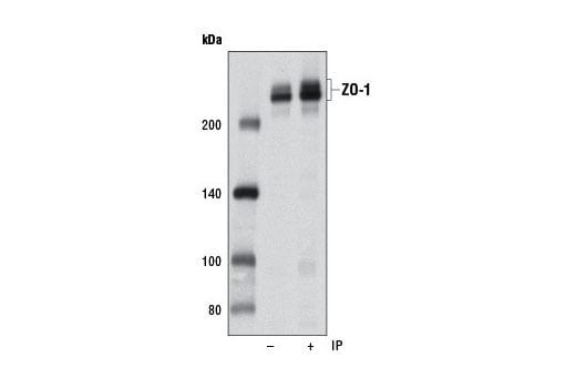 undefined Image 12: Tight Junction Antibody Sampler Kit