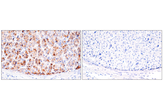 Immunohistochemistry Image 2: AFP (C3) Mouse mAb