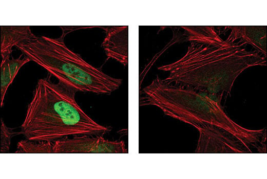 Immunofluorescence Image 1: Hydroxy-HIF-1α (Pro564) (D43B5) XP<sup>®</sup> Rabbit mAb