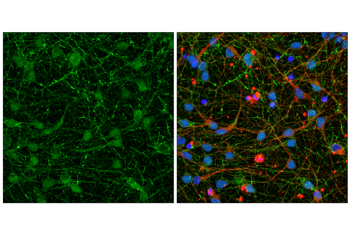 undefined Image 46: Tau Mouse Model Neuronal Viability IF Antibody Sampler Kit