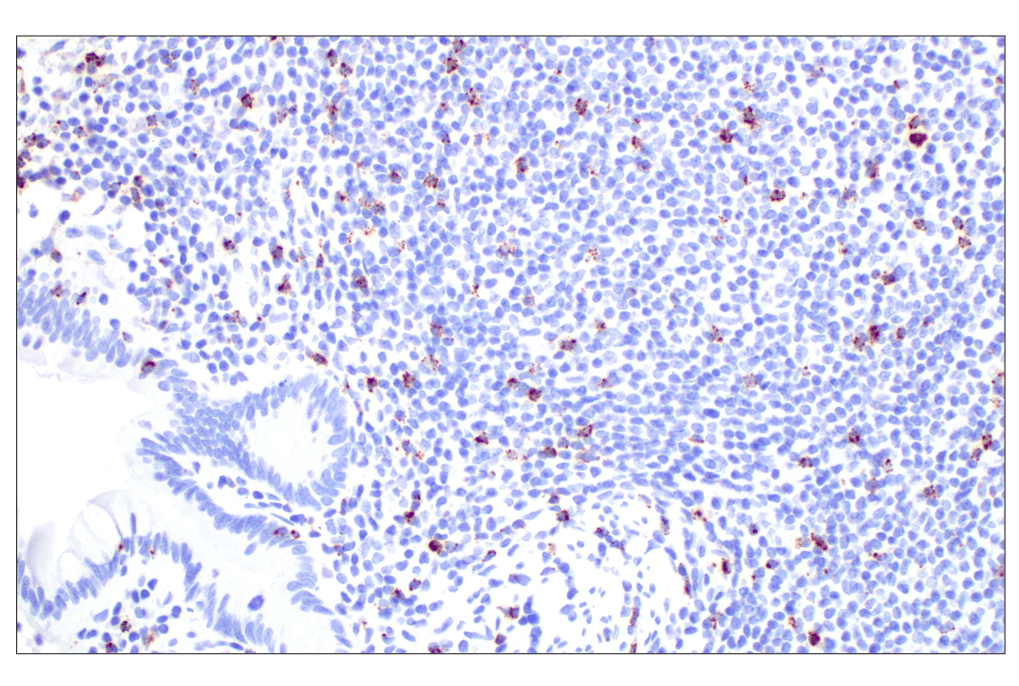 Immunohistochemistry Image 6: NKG7 (F4V5I) Rabbit mAb (BSA and Azide Free)