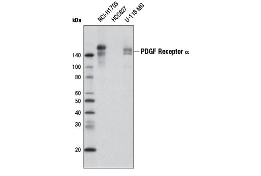 Western Blotting Image 1: PDGF Receptor α (D13C6) XP<sup>®</sup> Rabbit mAb (Biotinylated)