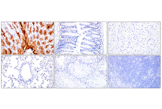 Immunohistochemistry Image 2: MUC5AC (E9V1O) XP<sup>®</sup> Rabbit mAb (BSA and Azide Free)