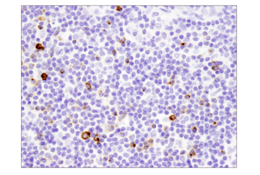 Immunohistochemistry Image 1: LAG3 (D2G4O<sup>™</sup>) XP<sup>®</sup> Rabbit mAb (BSA and Azide Free)