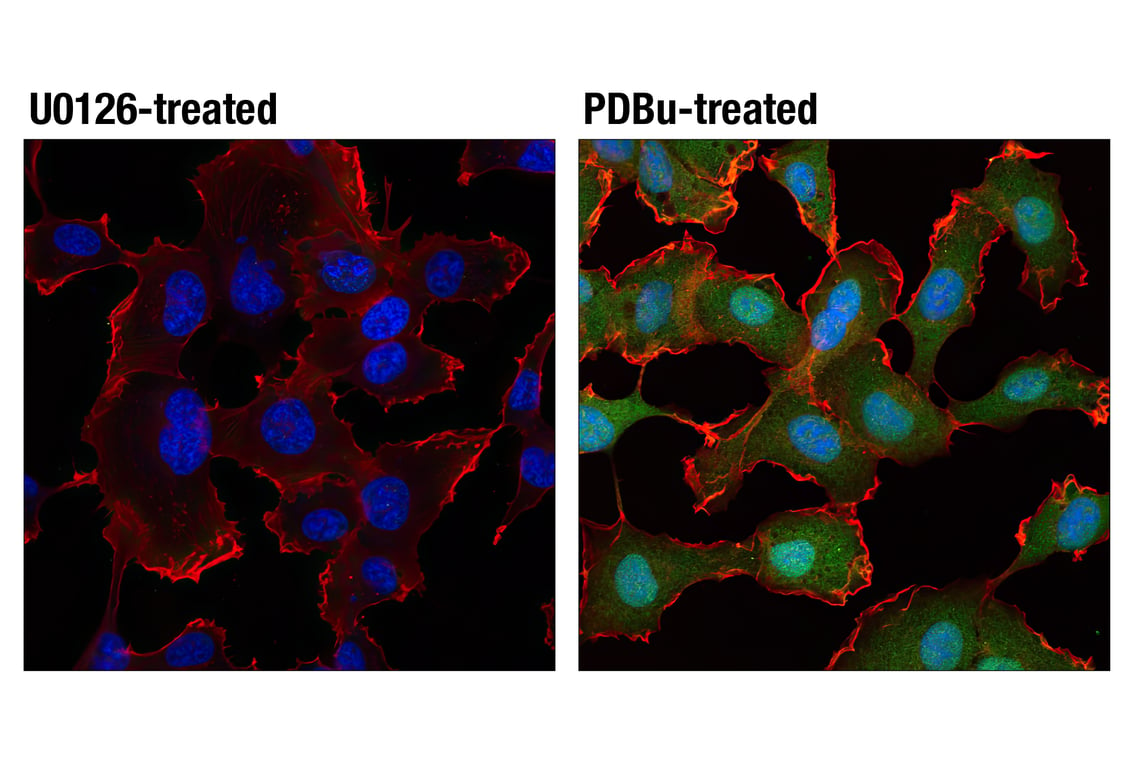 Immunofluorescence Image 2: Phospho-p44/42 MAPK (Erk1/2) (Thr202/Tyr204) (D13.14.4E) XP<sup>®</sup> Rabbit mAb