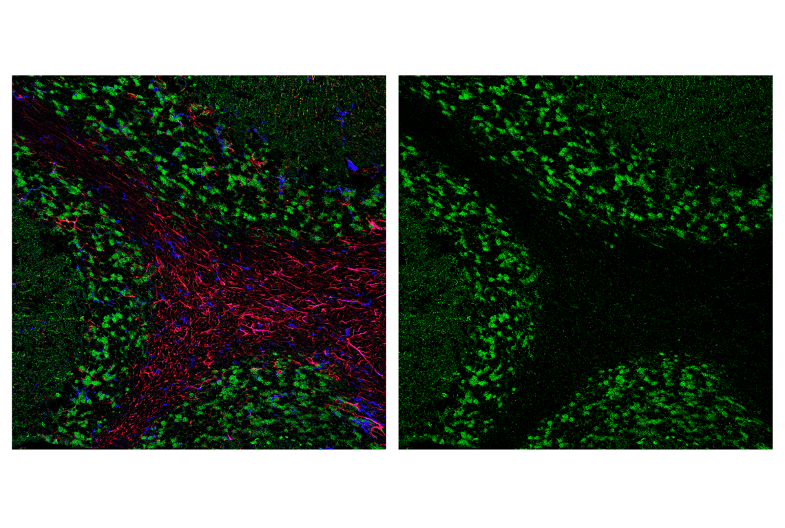undefined Image 27: Cell Fractionation Antibody Sampler Kit