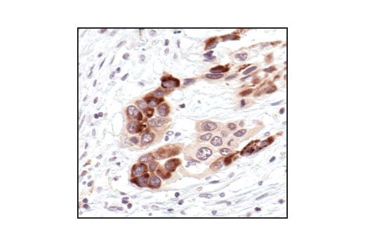 undefined Image 8: PhosphoPlus<sup>®</sup> IκBα (Ser32/Ser36) Antibody Duet