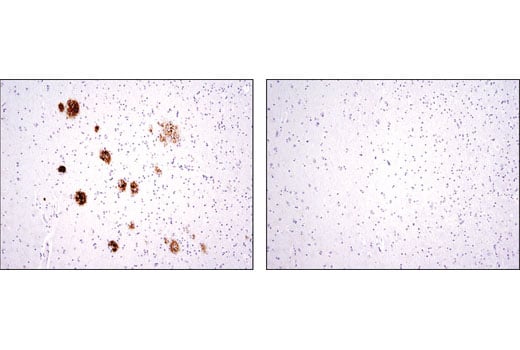 Immunohistochemistry Image 1: β-Amyloid (D12B2) Rabbit mAb
