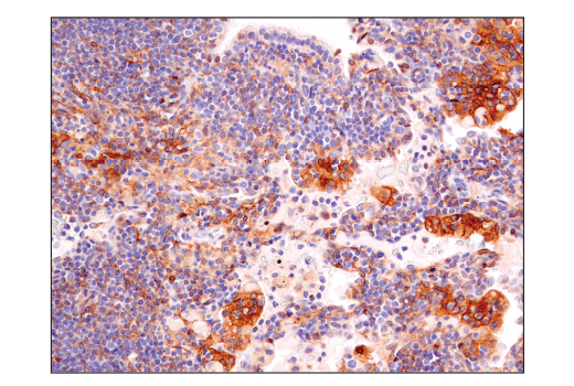 Immunohistochemistry Image 5: Notch2 (D76A6) XP<sup>®</sup> Rabbit mAb (BSA and Azide Free)