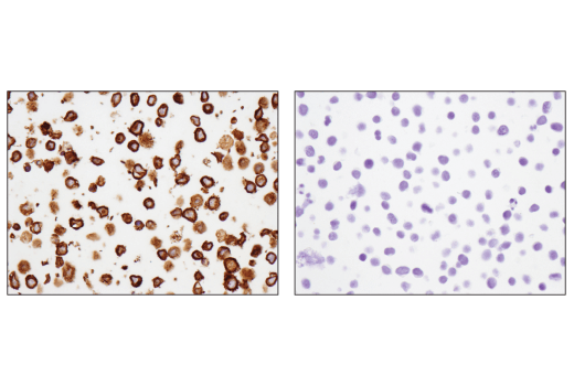 Immunohistochemistry Image 1: CD79B (D7V2F) Rabbit mAb