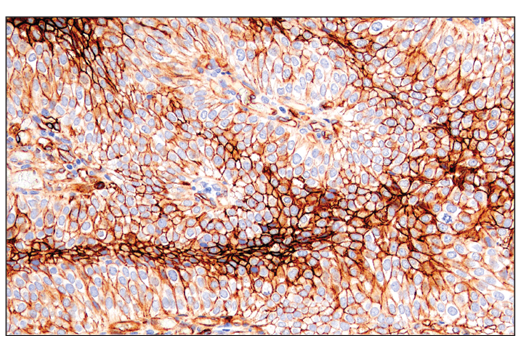 Immunohistochemistry Image 1: CD141/Thrombomodulin (E7Y9P) XP<sup>®</sup> Rabbit mAb