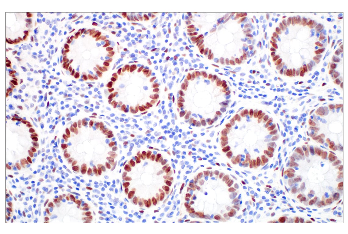 Immunohistochemistry Image 4: c-Fos (E2I7R) XP<sup>®</sup> Rabbit mAb