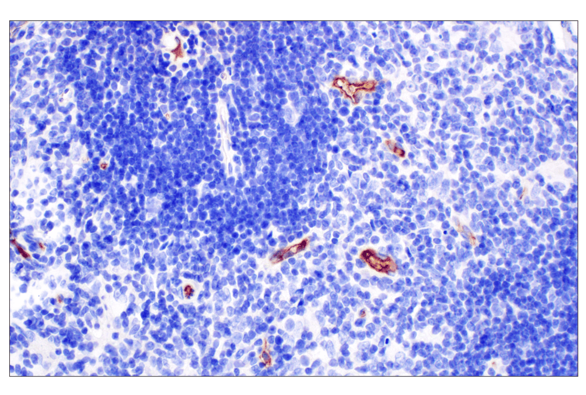 Immunohistochemistry Image 3: PNPLA3 (E7N6O) Rabbit mAb