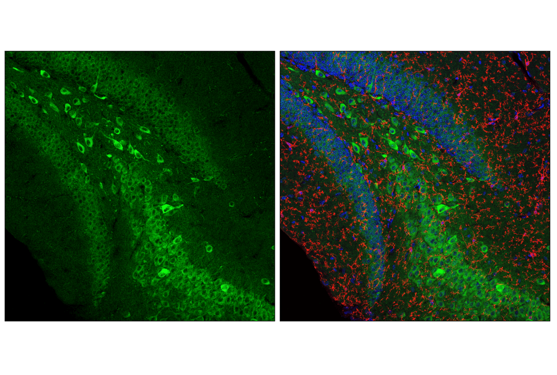 Immunofluorescence Image 1: VAPB (E7R3Z) Rabbit mAb