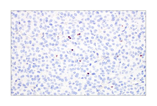 Immunohistochemistry Image 8: T-bet/TBX21 (E4I2K) Rabbit mAb