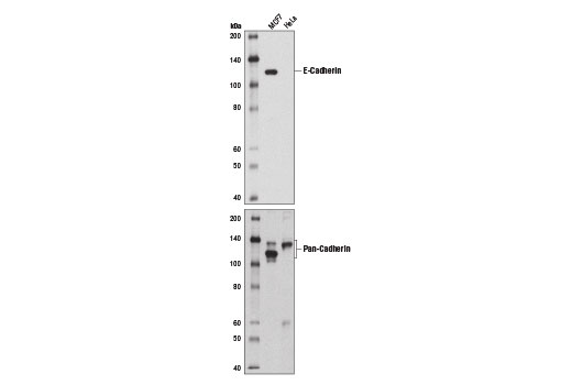 Western Blotting Image 2: E-Cadherin (4A2) Mouse mAb