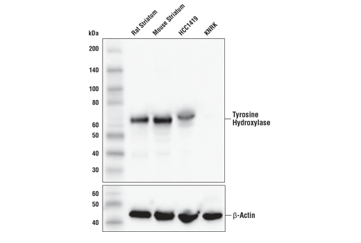 Western Blotting Image 1: Tyrosine Hydroxylase (E2L6M) Rabbit mAb