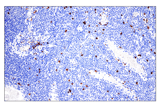 Immunohistochemistry Image 3: CD20 (E7B7T) XP<sup>®</sup> Rabbit mAb (BSA and Azide Free)