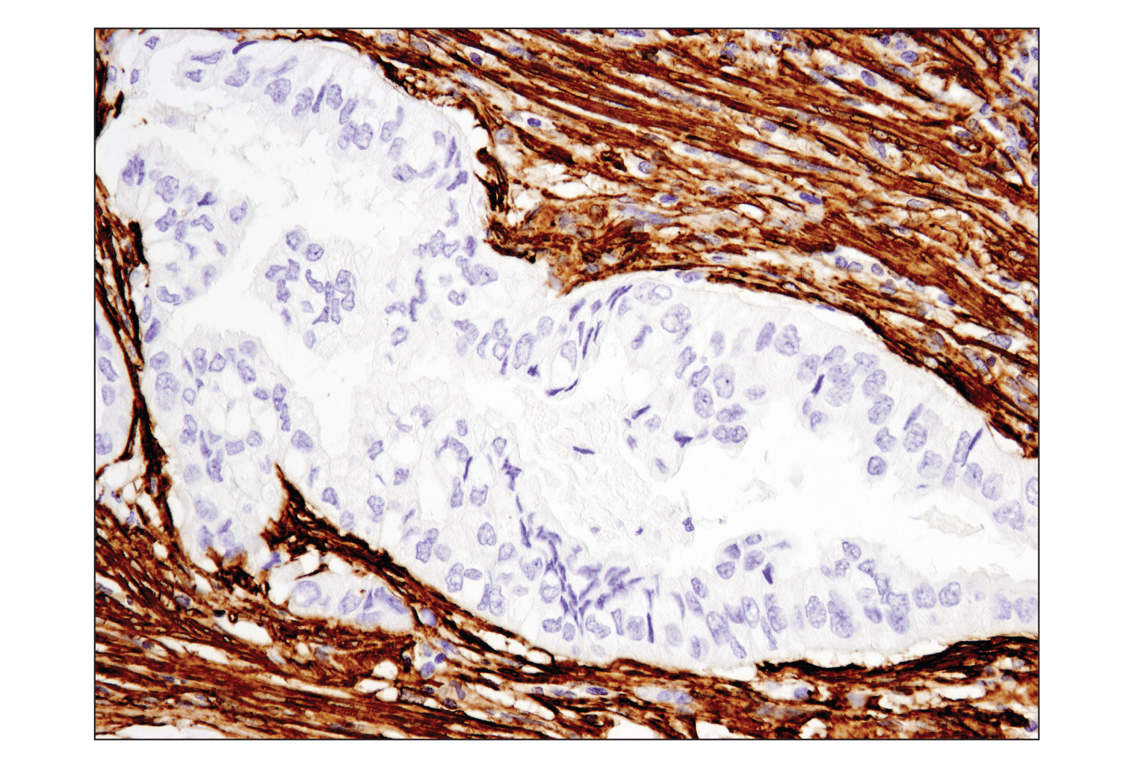 Immunohistochemistry Image 4: α-Smooth Muscle Actin (D4K9N) XP<sup>®</sup> Rabbit mAb (BSA and Azide Free)