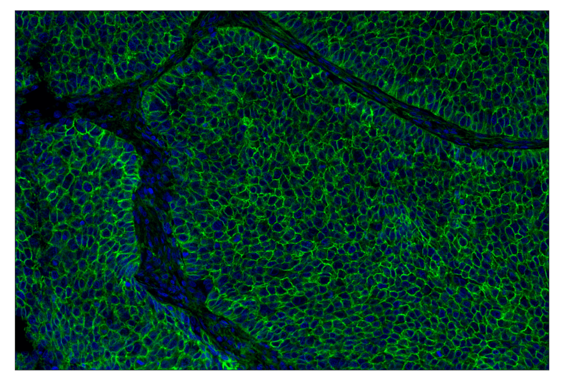 Immunohistochemistry Image 1: B7-H3 (D9M2L) XP<sup>®</sup> Rabbit mAb (Alexa Fluor<sup>®</sup> 488 Conjugate)