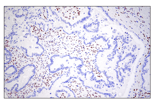 undefined Image 53: Epithelial-Mesenchymal Transition (EMT) IF Antibody Sampler Kit