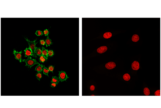 Immunofluorescence Image 1: CD45 (D3F8Q) Rabbit mAb