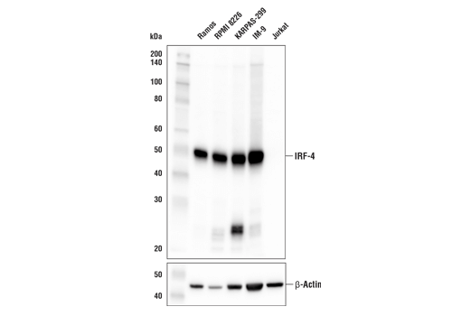 Western Blotting Image 1: IRF-4 (E8H3S) XP<sup>®</sup> Rabbit mAb (BSA and Azide Free)