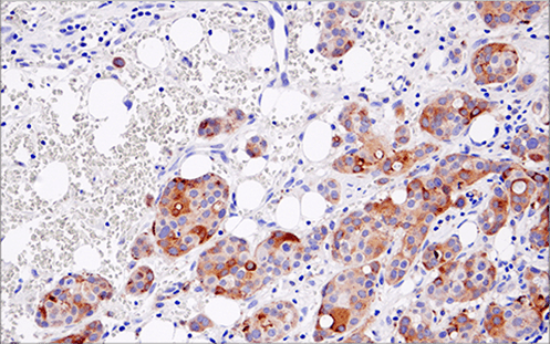 Immunohistochemical analysis of paraffin-embedded spleen using FoxP3 (D6O8R) Rabbit mAb