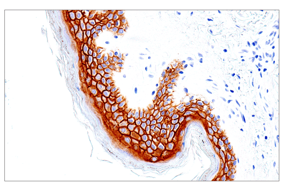 Immunohistochemistry Image 8: Syndecan 1 (E7F7T) Rabbit mAb