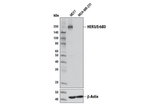 Western Blotting Image 1: HER3/ErbB3 (D22C5) XP® Rabbit mAb