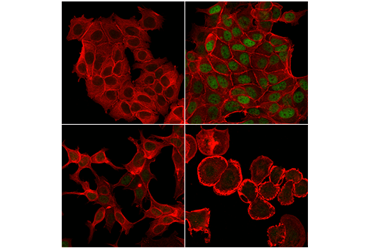 Immunofluorescence Image 1: Phospho-Estrogen Receptor α (Ser167) (D5W3Z) Rabbit mAb