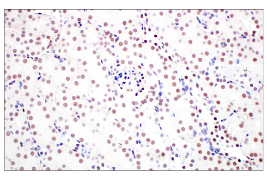 Immunohistochemistry Image 10: METTL14 (E2G9A) Rabbit mAb