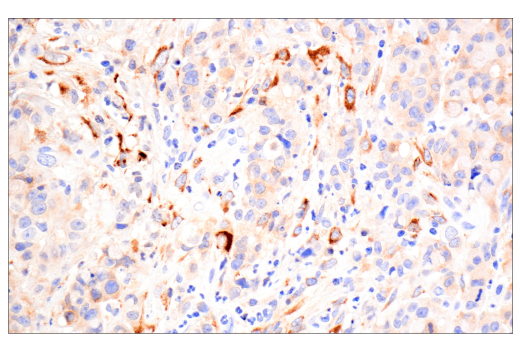 Immunohistochemistry Image 1: TIMP1 (D10E6) Rabbit mAb (BSA and Azide Free)