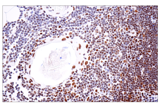 undefined Image 72: BAF Complex IHC Antibody Sampler Kit