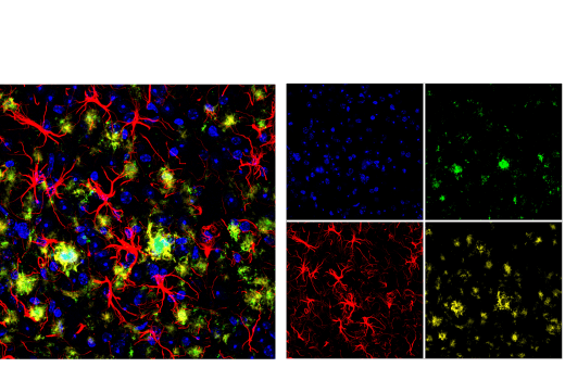 Immunofluorescence Image 1: β-Amyloid (1-43) (E8C2D) Rabbit mAb
