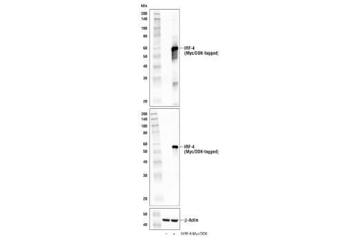 Western Blotting Image 2: IRF-4 (E8H3S) XP<sup>®</sup> Rabbit mAb (BSA and Azide Free)