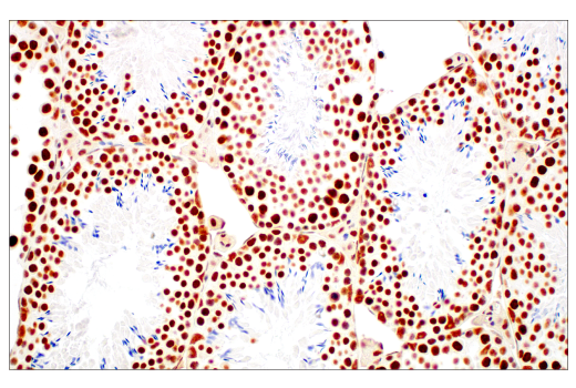 Immunohistochemistry Image 9: METTL3 (E3F2A) Rabbit mAb (BSA and Azide Free)