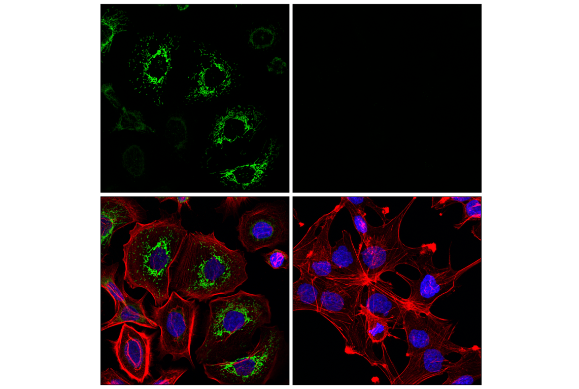 Immunofluorescence Image 1: GATM (F6S8W) Rabbit mAb