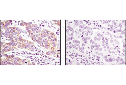 Immunohistochemistry Image 2: MRPL11 (D68F2) XP<sup>®</sup> Rabbit mAb