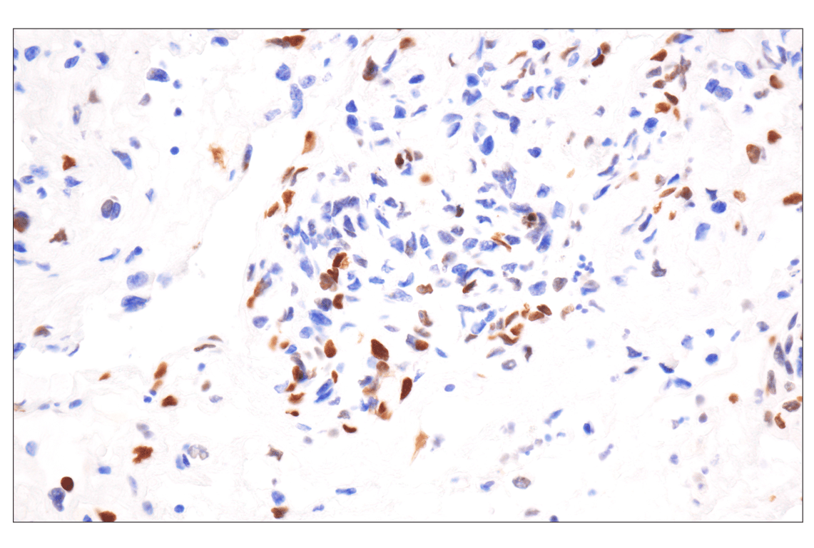 Immunohistochemistry Image 1: Phospho-Histone H2A.X (Ser139) (20E3) Rabbit mAb