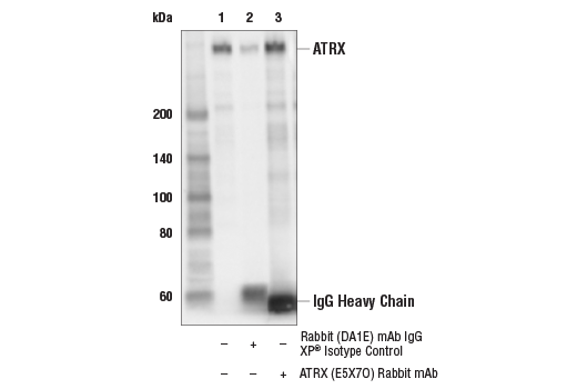 Immunoprecipitation Image 1: ATRX (E5X7O) Rabbit mAb