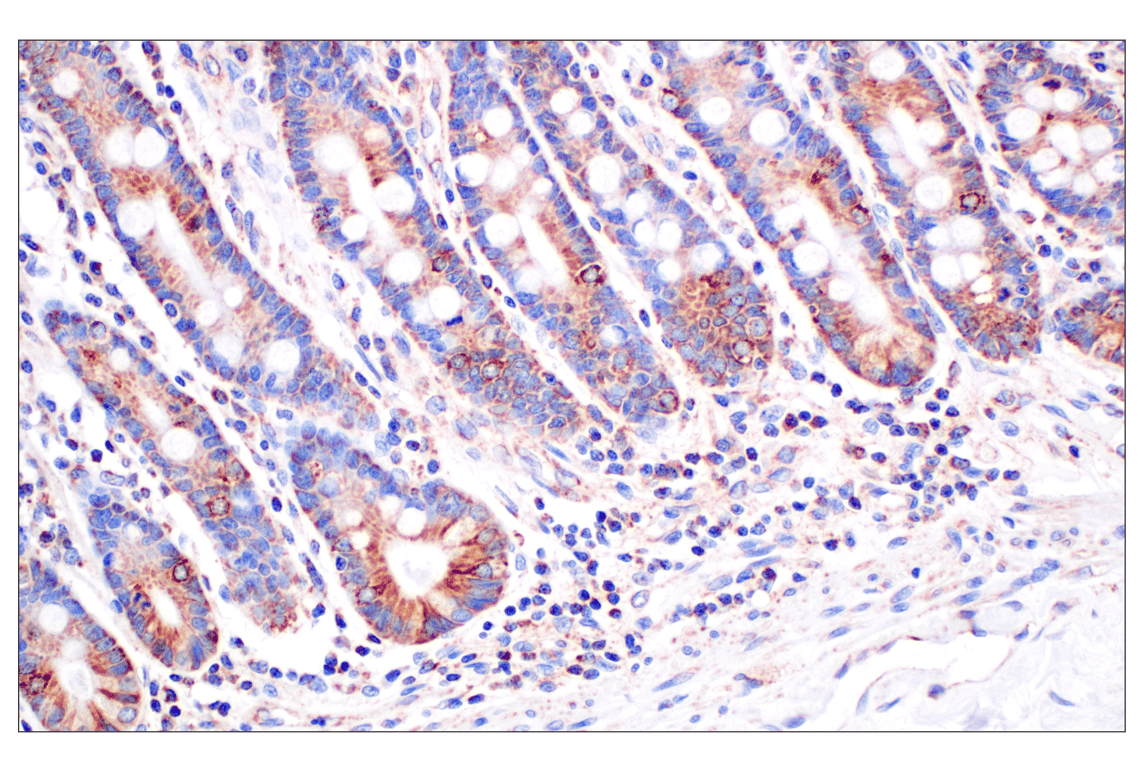 Immunohistochemistry Image 4: CPT1A (E3Y1V) Rabbit mAb