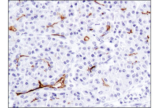 Immunohistochemistry Image 4: CD133 (D4W4N) XP<sup>®</sup> Rabbit mAb (BSA and Azide Free)