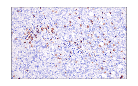 Immunohistochemistry Image 6: LAT (E3U6J) XP<sup>®</sup> Rabbit mAb (BSA and Azide Free)