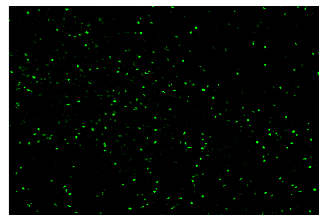 Immunohistochemistry Image 1: T-bet/TBX21 (E4I2K) & CO-0077-647 SignalStar™ Oligo-Antibody Pair