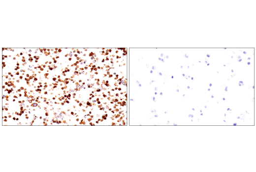 Immunohistochemistry Image 7: TNFRSF13C/BAFF-R (E3C1Q) XP<sup>®</sup> Rabbit mAb (BSA and Azide Free)