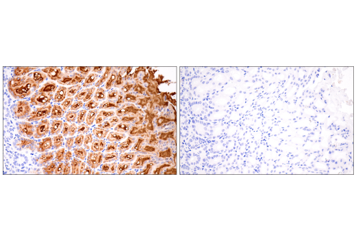 Immunohistochemistry Image 4: MUC5AC (E9V1O) XP<sup>®</sup> Rabbit mAb (BSA and Azide Free)
