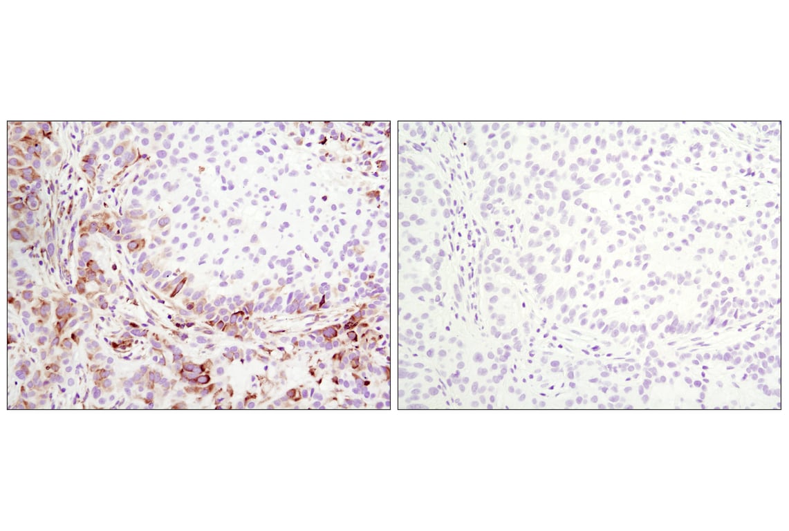 Immunohistochemistry Image 5: Phospho-S6 Ribosomal Protein (Ser235/236) (D57.2.2E) XP<sup>®</sup> Rabbit mAb (BSA and Azide Free)